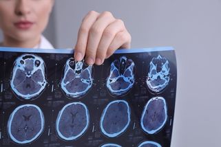 Lidé nevnímají signály svého těla, říká expertka na roztroušenou sklerózu - Seznam Zprávy